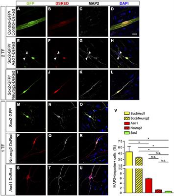 Direct Reprogramming of Adult Human Somatic Stem Cells Into Functional Neurons Using Sox2, Ascl1, and Neurog2